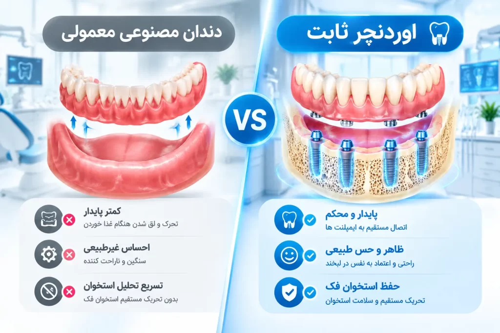 مقایسه اوردنچر ثابت و دندان مصنوعی