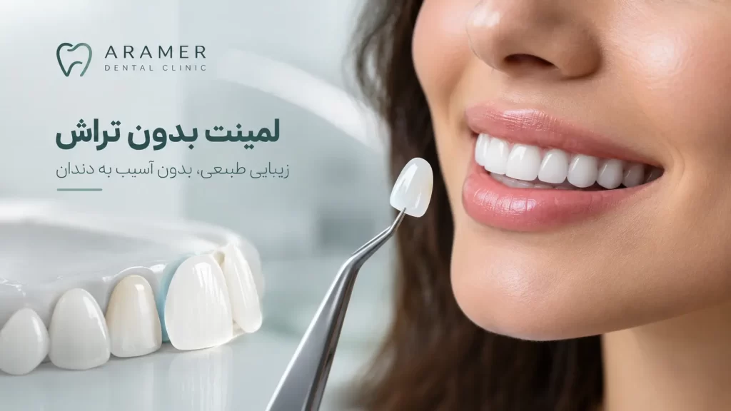 لمینیت بدون تراش