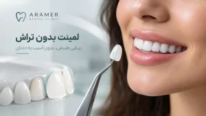 لمینیت بدون تراش