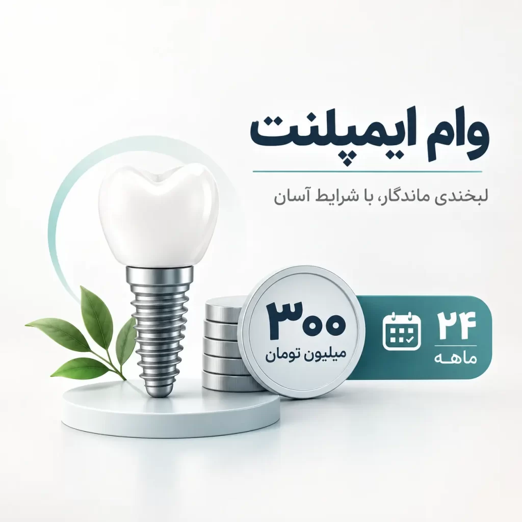 وام ایمپلنت