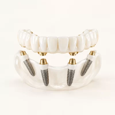 overdenture-hero2